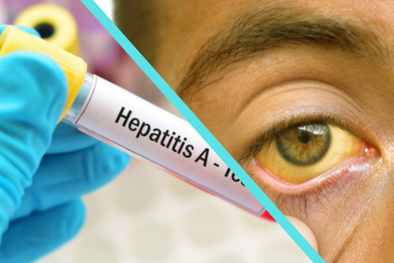 Спалаху гепатиту А на Закарпатті наразі не зафіксовано, хоча є госпіталізовані дорослі та діти.