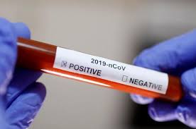 За минулу добу у 221 пацієнта підтверджено коронавірус методом ПЛР. З них 18 - медики та 14 - діти.