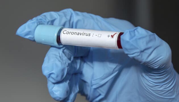 В місці компактного проживання ромів у Підвиноградові ПЛР-тестуванням підтверджено випадок захворювання на коронавірус.