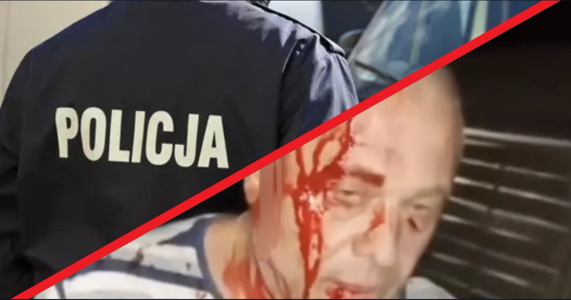 Жорстокий напад на родину українців у Польщі: нападник мав при собі предмет із металевим лезом (ВІДЕО 18+)