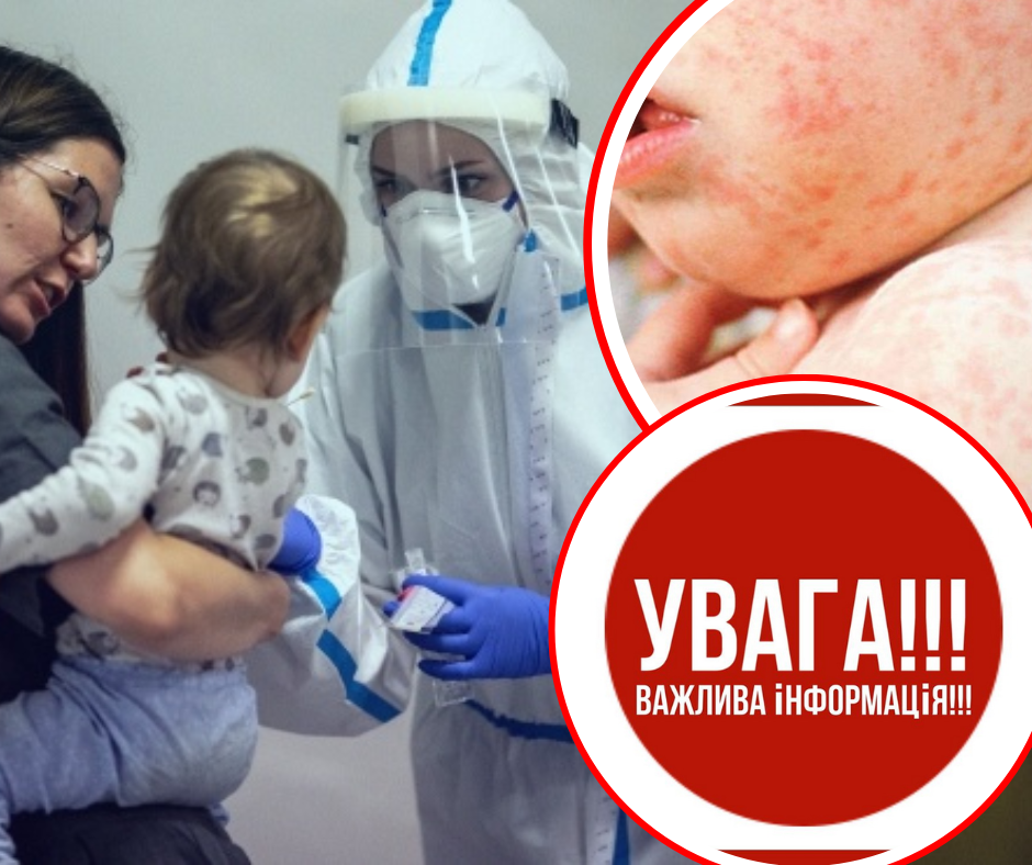 Закарпатців попереджають про небезпеку: в одному з районів області масового хворіють діти