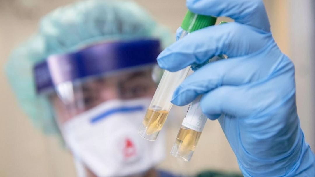 Станом на 12.00 годину 5 квітня в інфекційному відділенні Іршавської ЦРЛ троє пацієнтів очікують результати лабораторних тестів на коронавірус.

