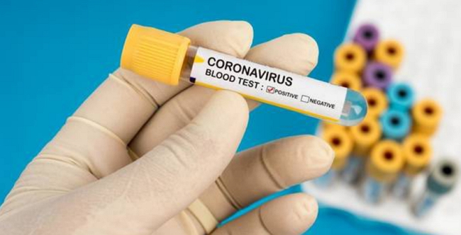 На Закарпатье на коронавирус заболел первый врач.
