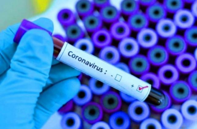По состоянию на 10.00 18 апреля в областном центре насчитывается 52 больных на коронавирус COVID-19.