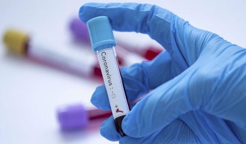 На Рахівщині коронавірус забрав життя уже 19-ти людей