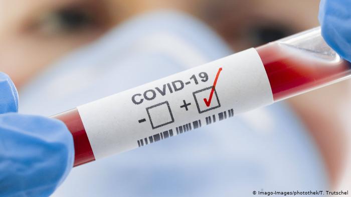 За прошедшие сутки 748 человек в Закарпатье подтвердили коронавирус методом ПЦР.