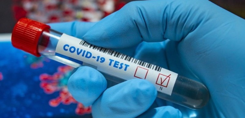 На Закарпатті за добу коронавірус підтвердили у 89 пацієнтів підтверджено коронавірус методом ПЛР. З них - 7 медиків та 4 дітей.