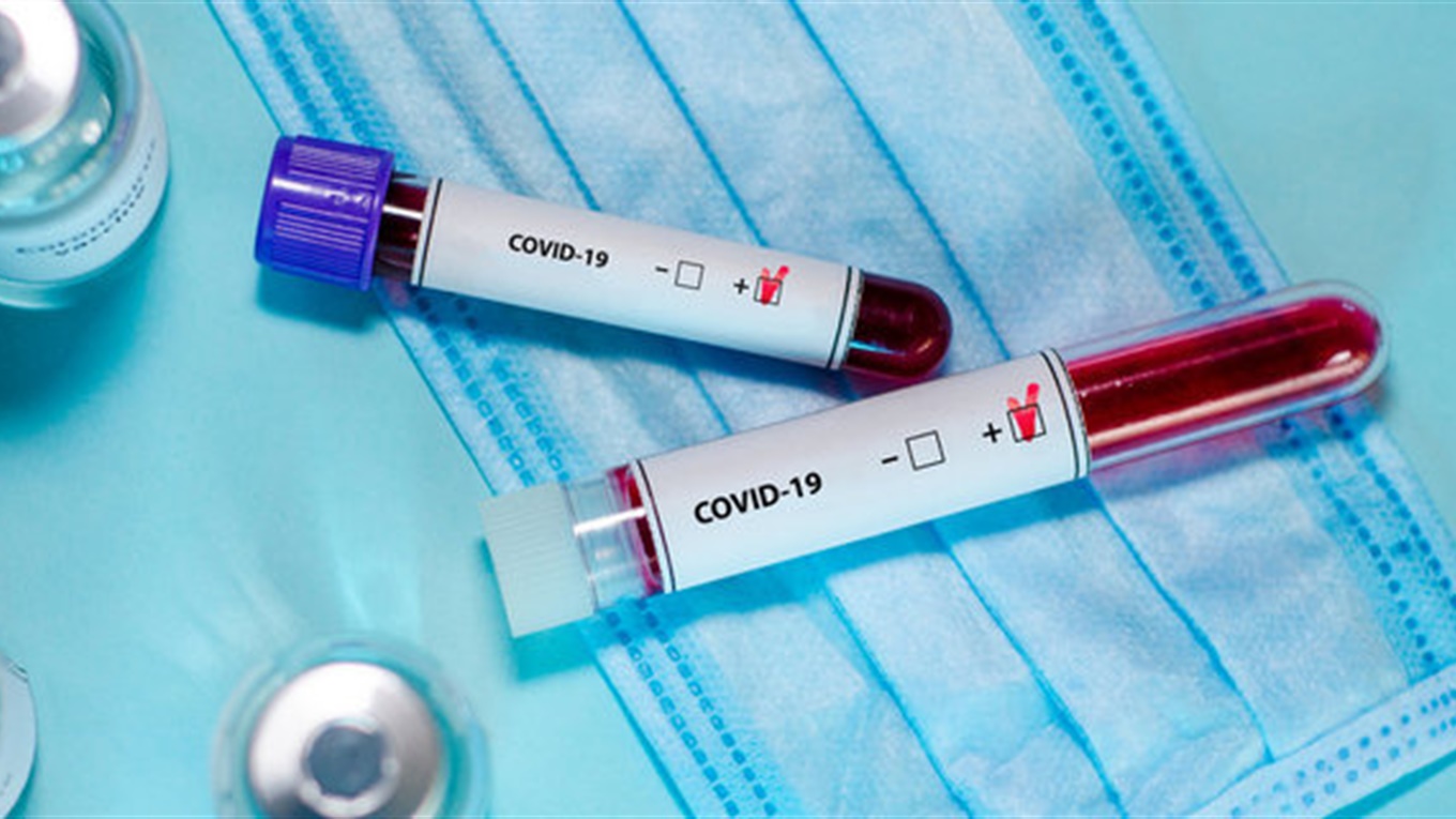 На внеочередном заседании Государственной комиссии по ТЕБ-НС, которое состоялось 10 сентября, было принято решение об установлении эпидемических уровней распространения COVID-19.