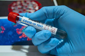 316 випадків коронавірусної хвороби  за добу  виявлено на Закарпатті. П'ятеро пацієнтів померло. 