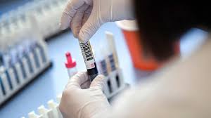 За минулу добу на Закарпатті зафіксовано 104 нові випадки коронавірусу.