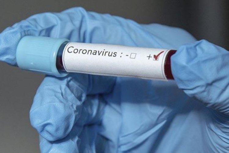 Всего в области 28 подозрений на коронавирус, девять - ожидают результаты тестов.