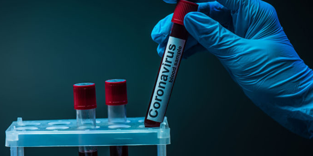 В Закарпатье за сутки диагностировали 271 новый случаев коронавируса.