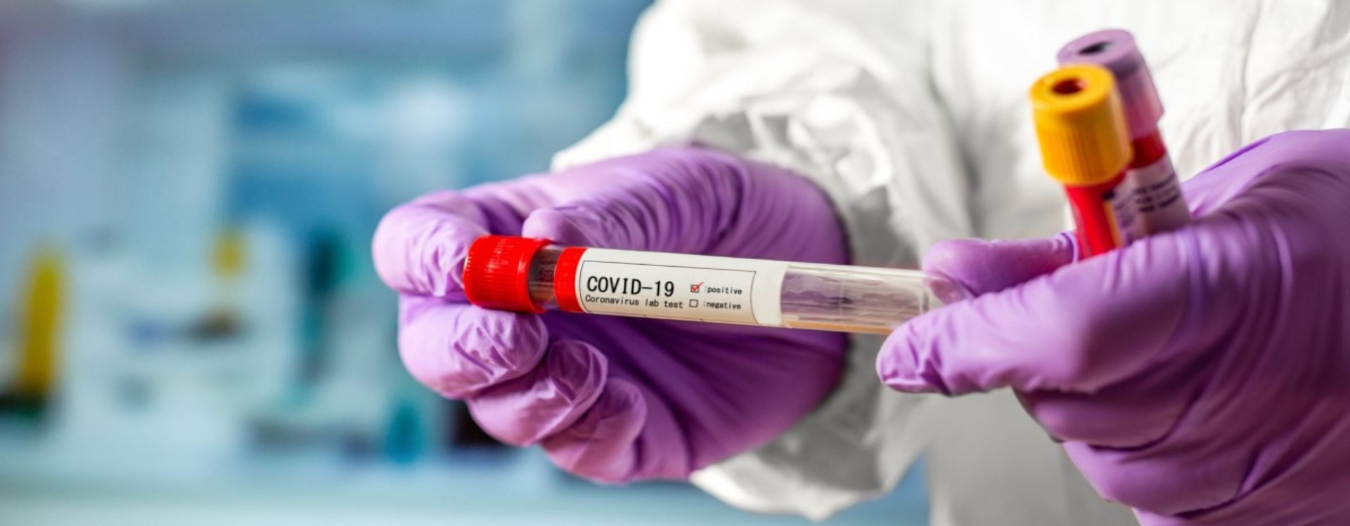 Про стан захворюваності на COVID-19 в Мукачеві станом на 10 травня повідомили у Мукачівській ОТГ