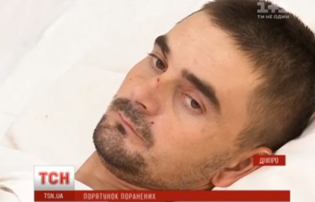 25-річний закарпатець Віктор осколками був поранений, перебуваючи в північній частині Донецька, неподалік шахти Бутівка.