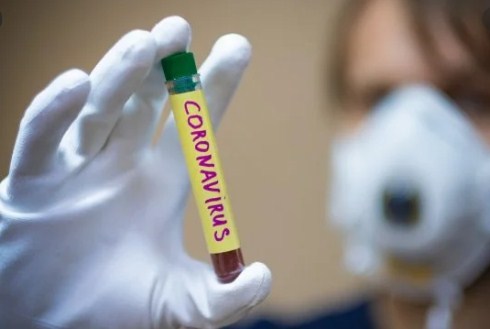 Первый случай заболевания COVID-19 на территории Виноградовского района был лабораторно подтвержден 8 апреля.