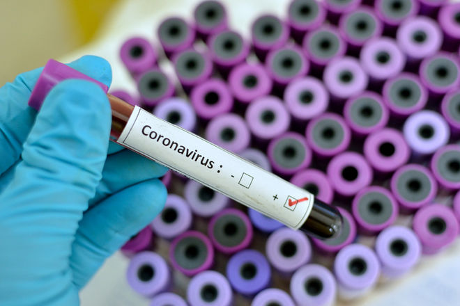 Про вакцину проти смертельного коронавірусу 2019-nCoV повідомляють азіатські ЗМІ.