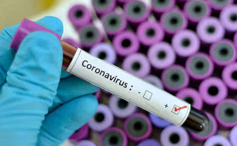 Закарпатской области нет в перечне среди восьми регионов Украины, куда в первую очередь направляют тестсистеми для проверки на коронавирус
