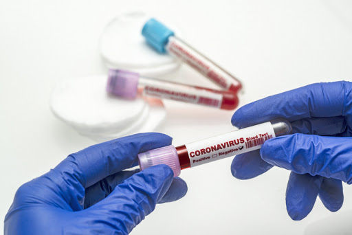 За минулу добу у 276 осіб підтверджено коронавірус методом ПЛР. Про це повідомляють у прес-центрі Закарпатської ОДА.