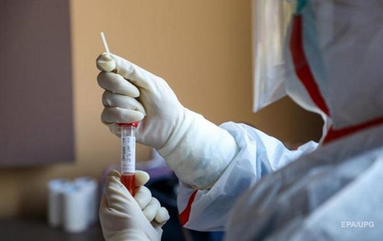 Коронавірусну інфекцію виявлено уже у понад 400 жителів Закарпаття