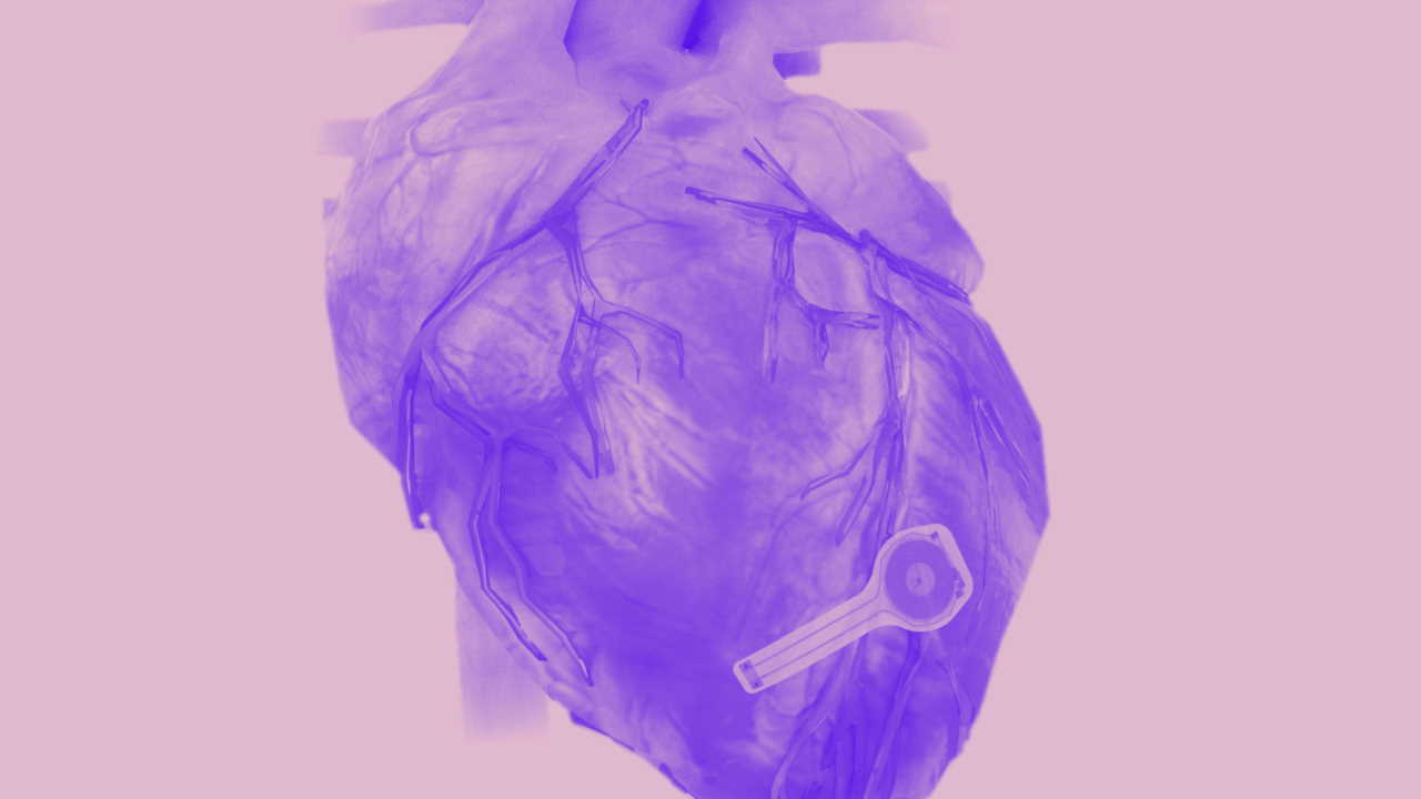 Прототип повністю автономного тимчасового кардіостимулятора для імплантації в серце створили американські науковці.