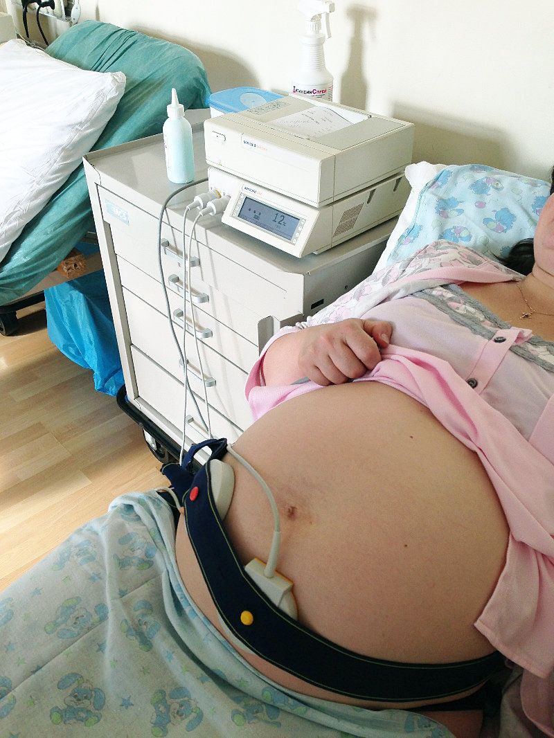 У вісьмох лікарнях Закарпаття з'являться нові апарати телеметричних кардіографів для вагітних.
