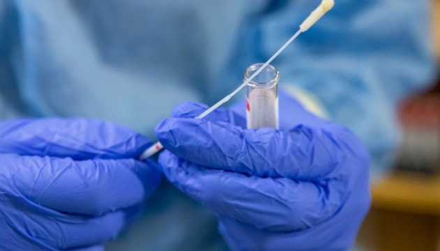 В Закарпатье за сутки зарегистрировано 9 новых случаев коронавируса, ни один пациент не умер. Об этом сообщает департамент здравоохранения Закарпатской областной государственной администрации.