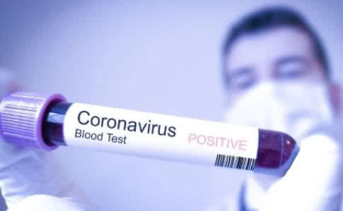 За минулу добу на Закарпатті виявлено 29 випадків коронавірусу. Про це повідомляють у Департаменті охорони здоров’я Закарпатської ОДА.