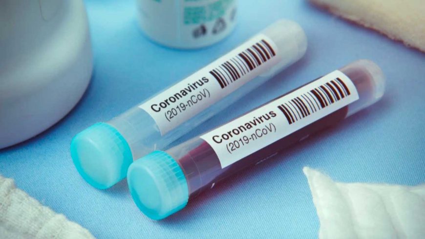 Станом на ранок 31 січня в Закарпатті за минулу добу у 684 осіб підтверджено коронавірус методом ПЛР.