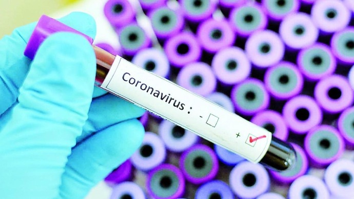 Щоденна інформація щодо коронавірусу в Ужгороді.