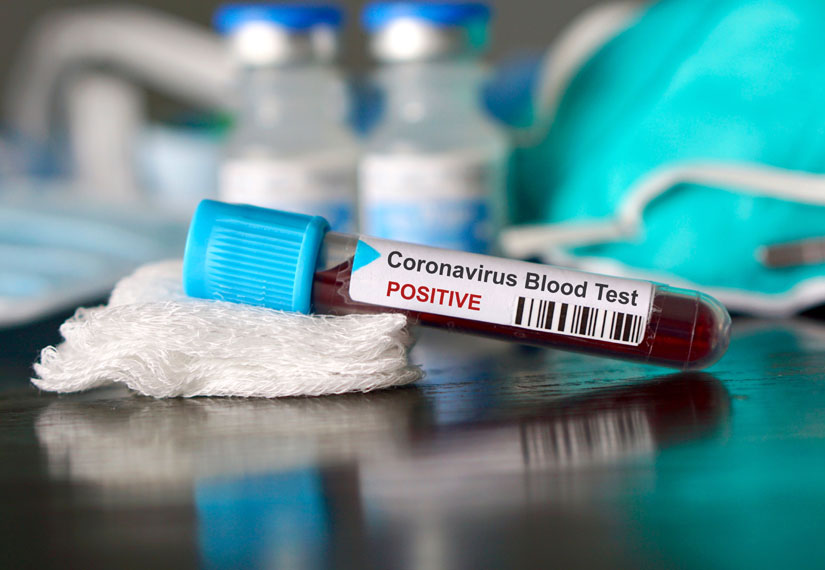 Уже седьмой случай заболевания коронавирусом відтвердили сегодня после обеда.