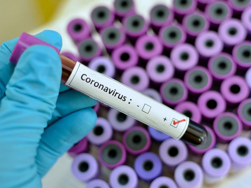 В сусідній Угорщині в середу підтвердила два перших випадки захворювання новим коронавірусом, обидва – у іранських студентів.