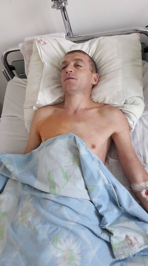 Допомоги на лікування потребує 34-річний Руслан Андрійович Добоні з Великої Копані.