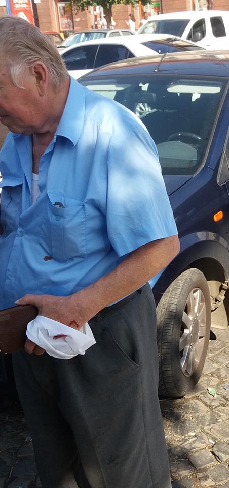 9 липня близько 10:00 біля ринку на Корятовича в Ужгороді п'ятеро дітей агресивно вирвали гаманець у літнього чоловіка. 