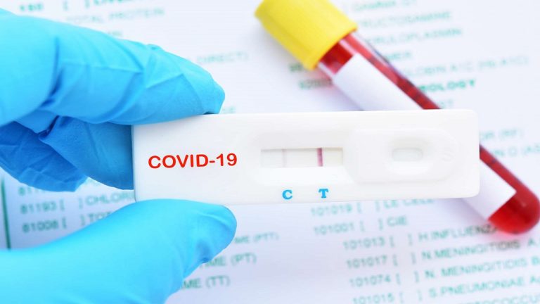 За последние 24 часа в Закарпатье выявлено 6 случаев коронавируса. Об этом сообщил Закарпатский областной центр общественного здоровья.
