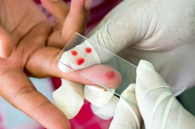 Медики фіксують зростання кількості хворих на гепатит С. Нині в Україні зареєстровано 46 тисяч людей із цим діагнозом.