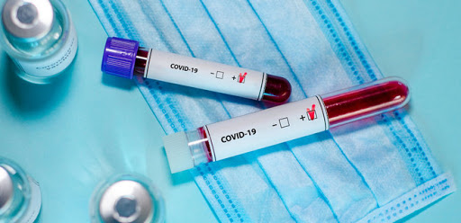 За оперативною інформацією, станом на 9.00 год. 08.05.2020 в Тячівському районі зареєстровано 17 випадків захворювання на коронавірусну інфекцію, 3 хворих одужало, 1 помер. 
