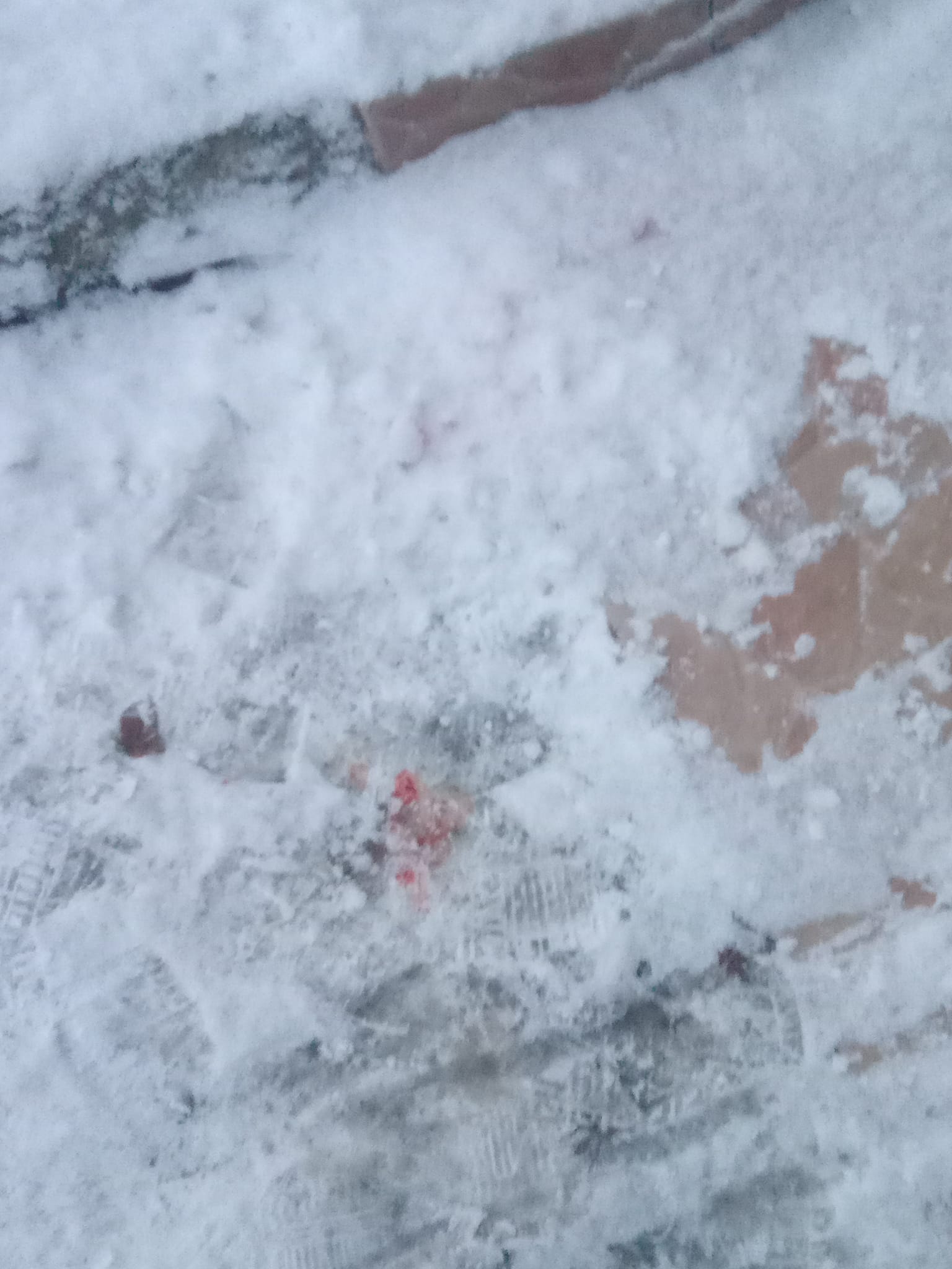 Надзвичайний випадок стався на зледенілих, нечищених від снігу  сходах амбулаторії сімейної медицини №5, вулиця Челюскінців,10  в  Ужгороді.