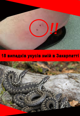В Закарпатській області від початку року вже зафіксували 18 випадків укусів змій.
