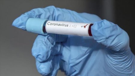 Информация о заболеваемости на коронавирус в Ужгороде по состоянию на утро 24 апреля.