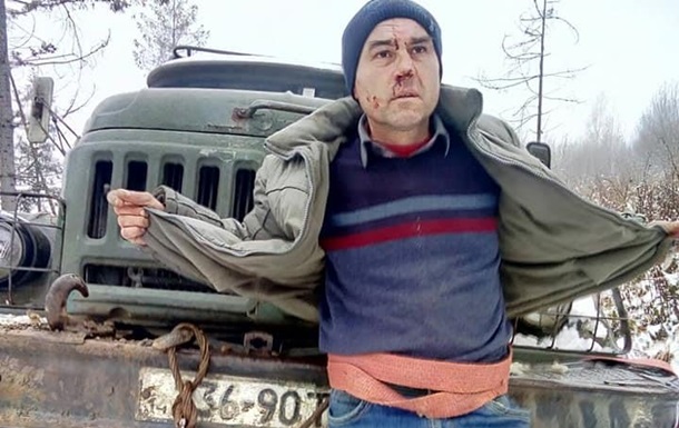 Житель Львівської області намагався зняти на телефон вирубку лісу. Лісоруби побили активіста і тросом прив'язали його до вантажівки.