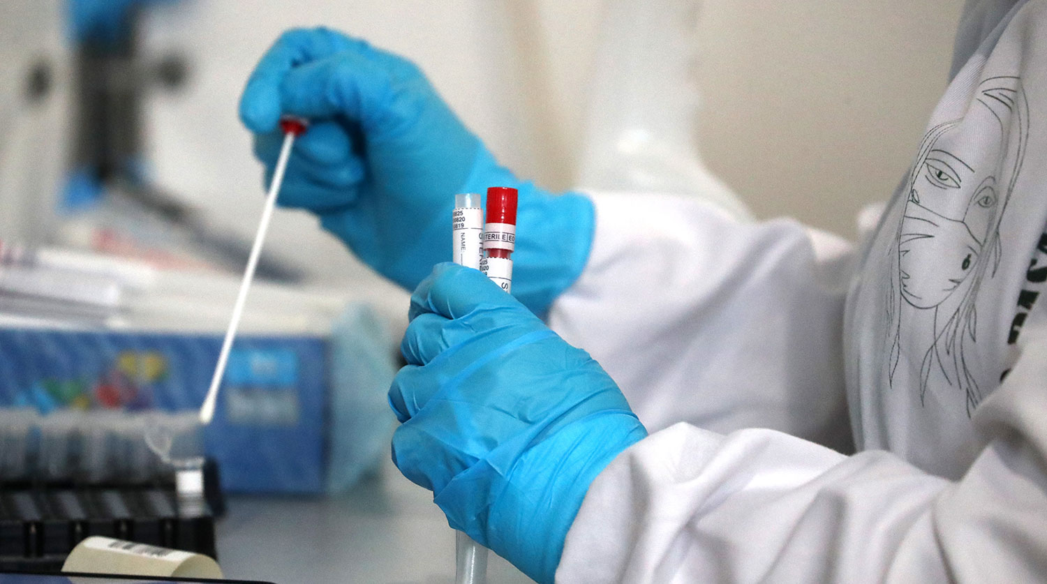 За прошедшие сутки коронавирус ПЦР подтвердили 103 человека в Закарпатье. Об этом сообщили в областном центре здравоохранения.