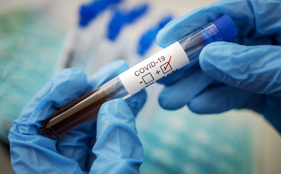  За прошедшие сутки выявлено 26 новых случаев коронавирусной инфекции, умер один человек.