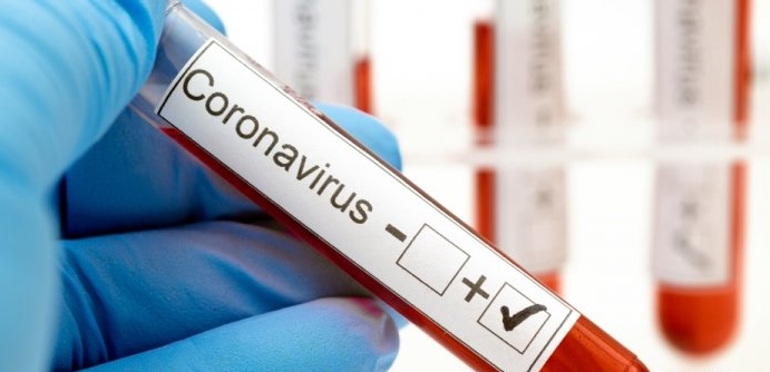В странах Центральной Европы в Австрии и Хорватии объявили о диагностировании коронавирус.