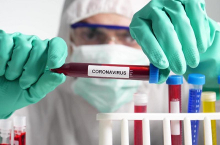 За минулу добу у 546 пацієнтів підтверджено коронавірус методом ПЛР. З них 34 - медики та 18 - діти. 15 осіб померло. 