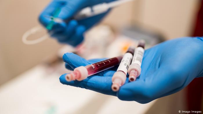 За сутки 15 сентября в Закарпатье подтверждено 54 новых случая коронавируса.