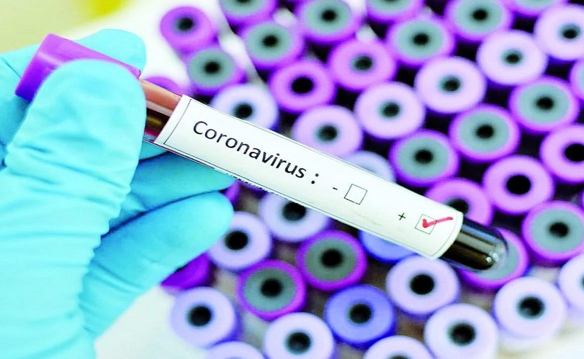 В Іршавській ЦРЛ зафіксували перший випадок захворювання на коронавірус COVID-19.