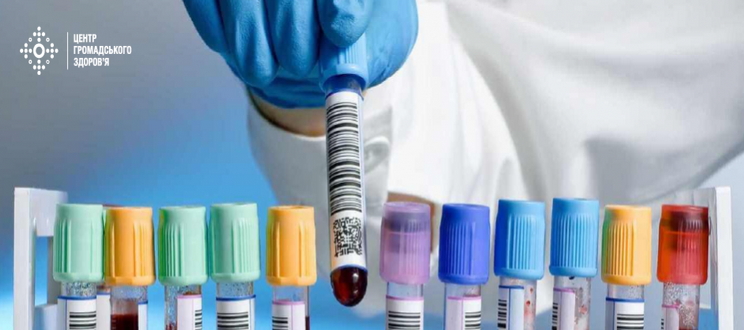 Центр громадського здоров‘я підготував рекомендації для лікарів первинної ланки для проведення тестування на гепатити В та С.