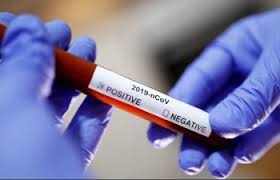 Министерство здравоохранения усиленно готовится ко второй волне пандемии коронавірусної болезни. По прогнозам украинских экспертов, она может начаться в Украине уже осенью.
