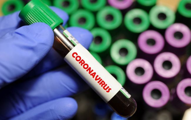 В Україні зафіксовано 8125 випадків коронавірусної хвороби COVID-19.