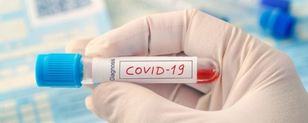 За добу на Закарпатті COVID-19 діагностували в 49 людей.
